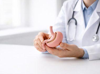 Bariatrisk kirurgi i Norge: hva det er og hvem som kvalifiserer